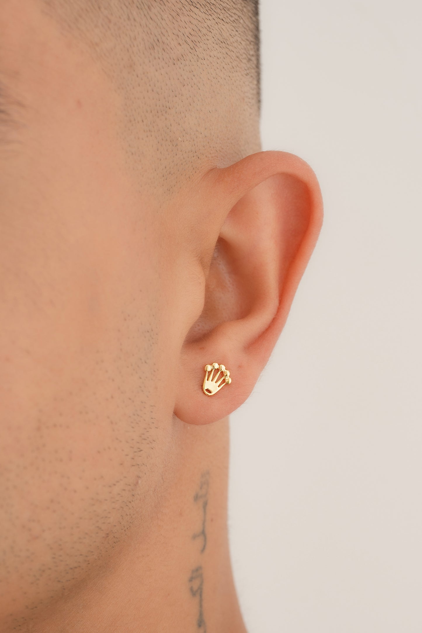 Arete Rolex